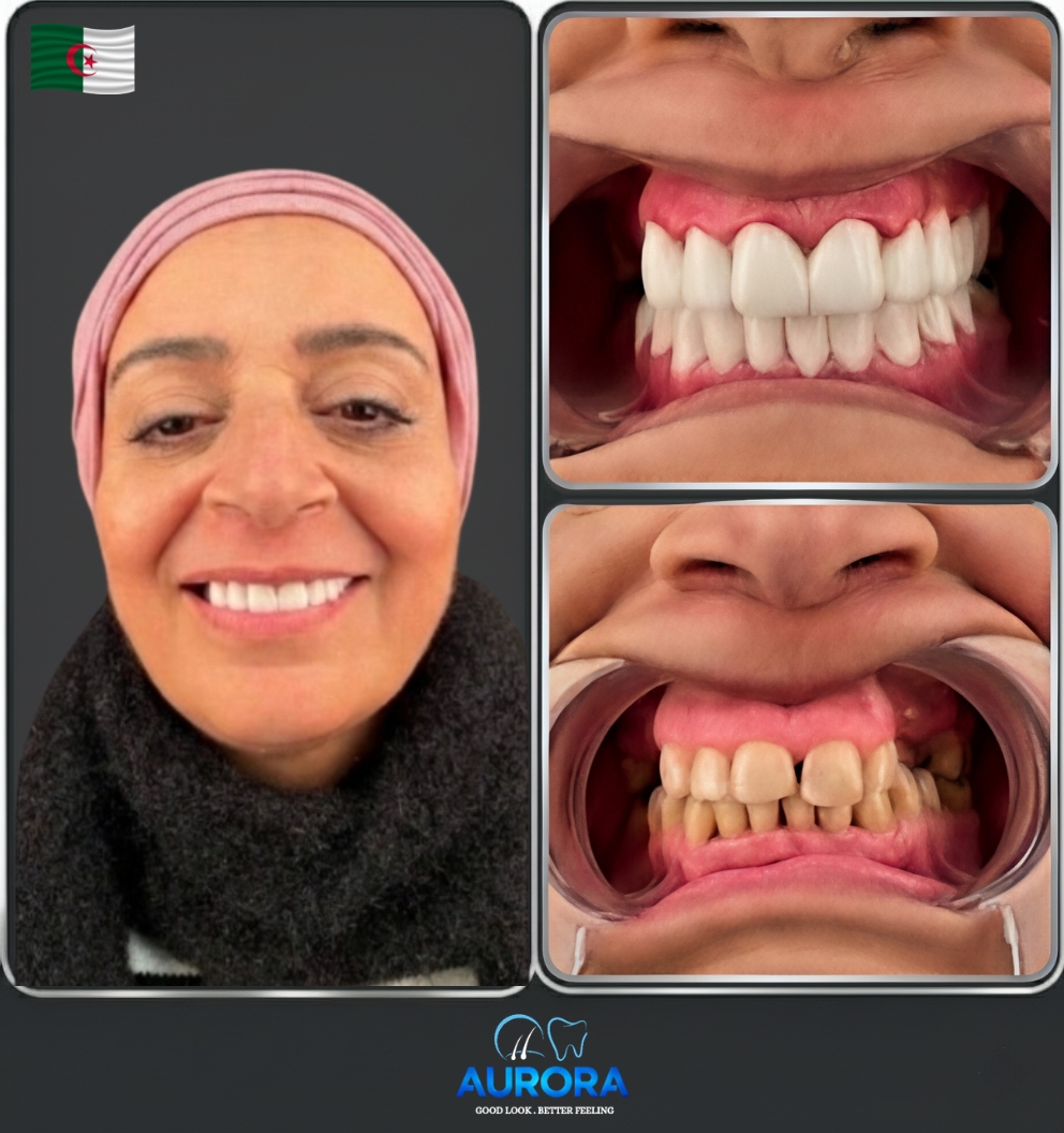 Aurora Client Experience Algeria