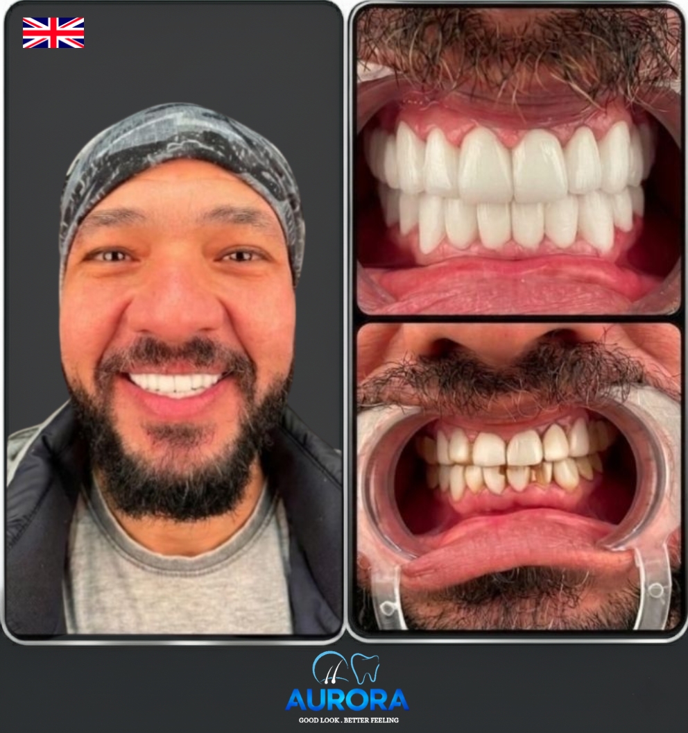 Aurora Client Experience UK